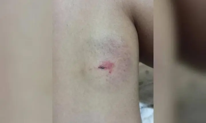 Adolescente de 16 anos é atacada por três cães próximo ao Mercado Fama, em Kaloré